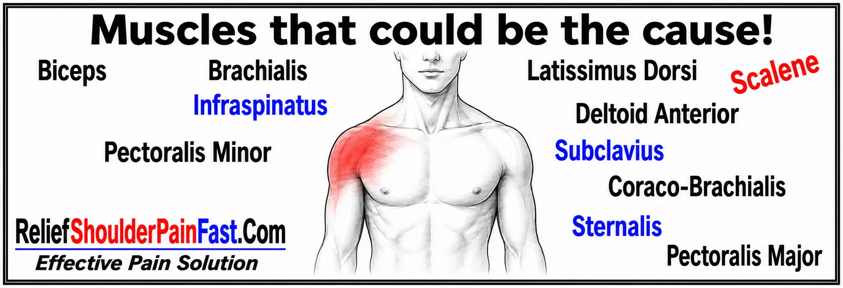 Muscles that may contribute to pain in the front of the shoulder