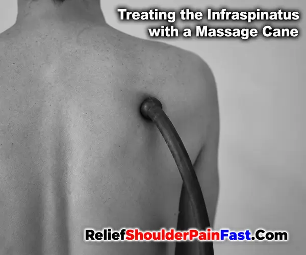 Step 3: deactivation of the infraspinatus trigger
                         points with a massage collarbone