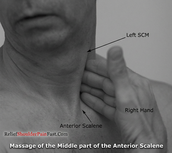 Step 2: Gently holding the SCM between the fingers