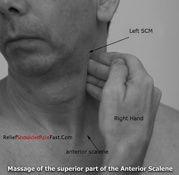 Step 1: Locating the scalene muscles