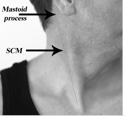 Location of the mastoid process behind the ear