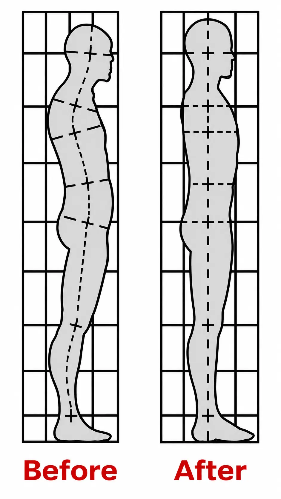 Illustration comparing posture before 
                         and after a postural process