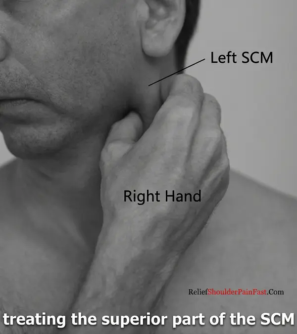 Step 1: Locating the sternocleidomastoid muscle