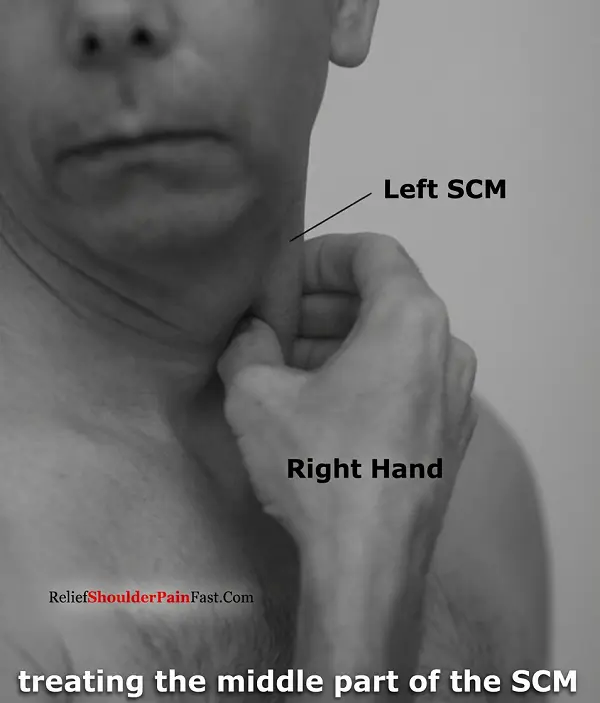 Step 2: Gently holding the SCM between the fingers
