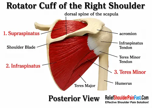 Anterior view of the rotator cuff showing the subscapularis