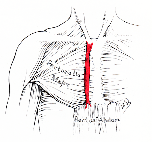 Location of the sternalis muscle