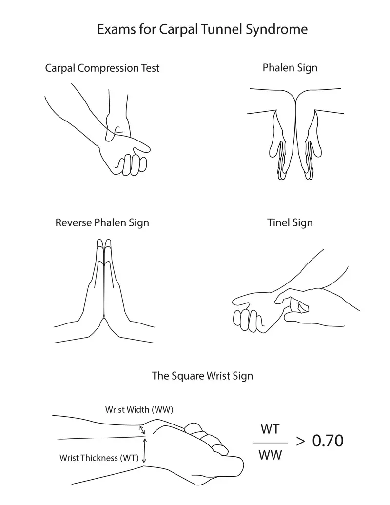 Phalen, reverse Phalen and wrist compression maneuvers used during a
           carpal tunnel physical examination
