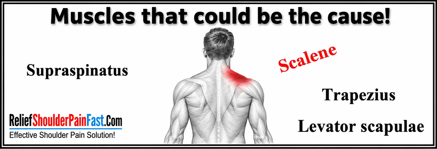 Muscles that may contribute to pain on the top of the shoulder